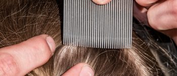 A close up of a fine-tooth comb being run through hair, along the scalp.