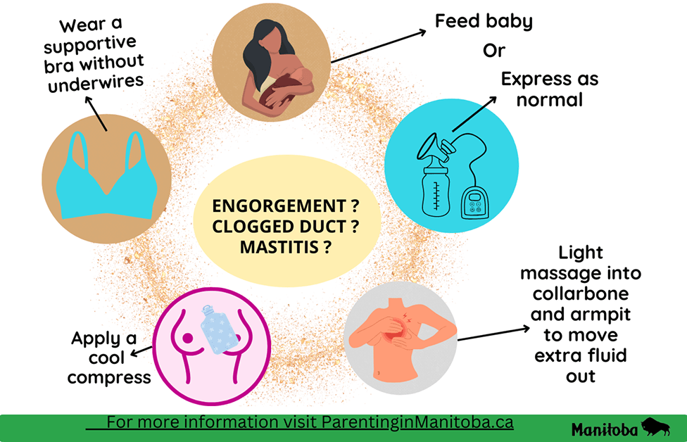 An informational graphic offering advice for parents on managing breast engorgement, blocked ducts, or mastitis. It includes illustrations of breastfeeding, a supportive bra, a breast pump, massage, and a cold compress, with text instructions and the Manitoba logo.
