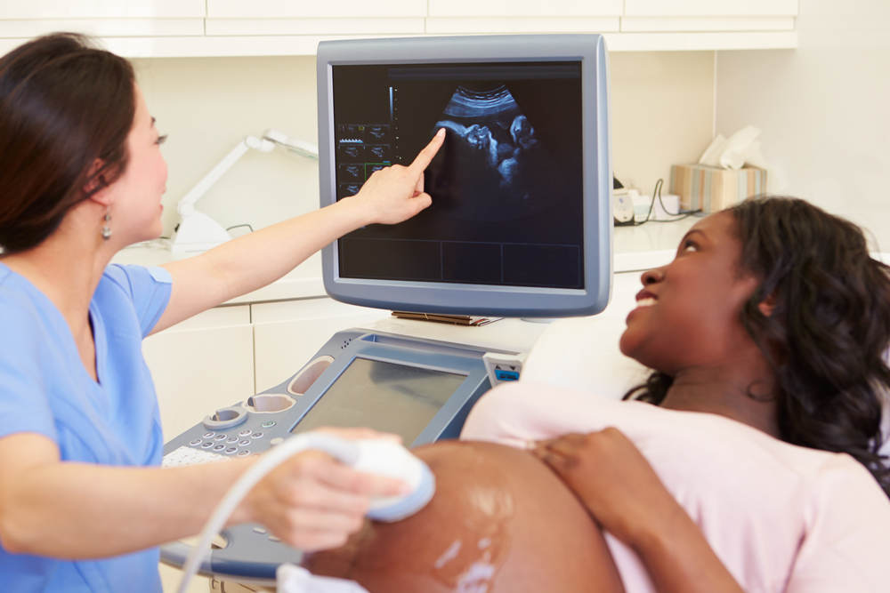 Healthcare professional performing an ultrasound on a pregnant patient, pointing to the monitor displaying the fetus